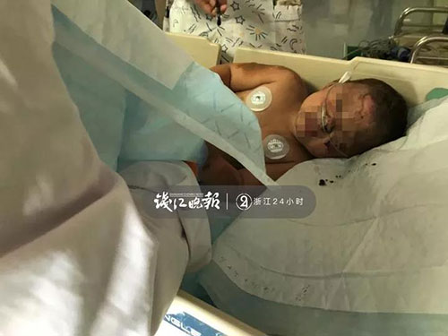 这就是杭州人！为救3岁烧伤女孩今早大家赶去把这家花威客电竞店买空了！(图1)